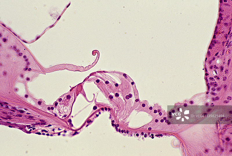内耳耳蜗柯蒂器结构图图片素材