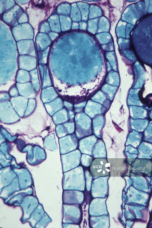 苔藓植物门地钱的 archegonium 具有卵；250 倍图片素材