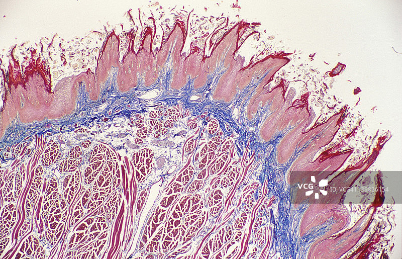 人舌乳头、上皮、结缔组织和肌肉显微照片图片素材