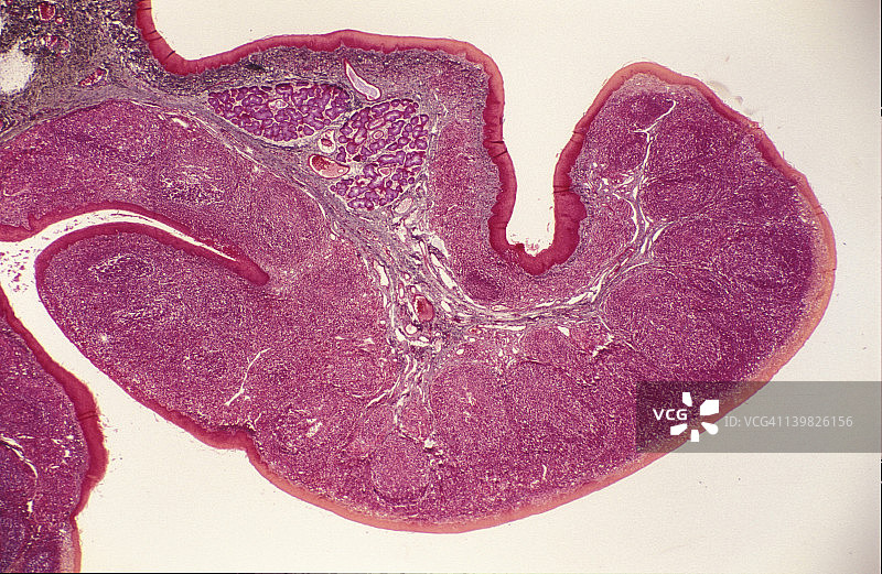 扁桃体淋巴结显微照片图片素材