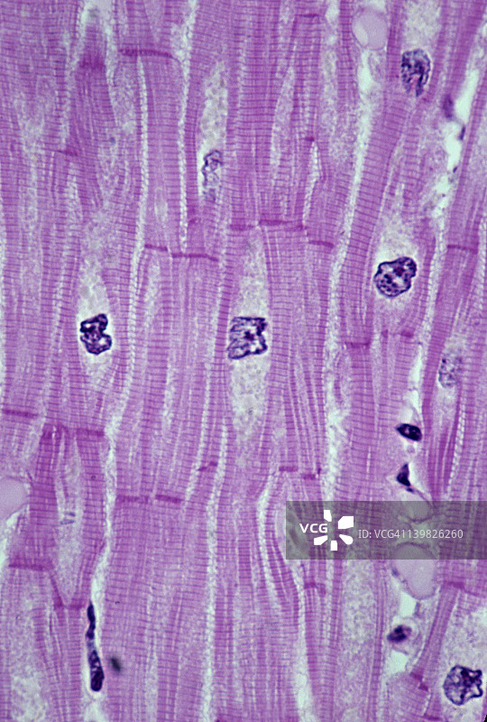 具有闰盘的心肌，250倍放大显示：合胞体（分支的，相互连接的细胞网络），条纹，细胞核和闰盘。不随意肌。图片素材
