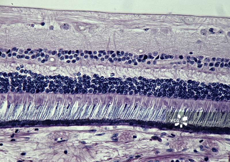 视网膜：感光细胞、双极神经元、神经节细胞、神经纤维、脉络膜和巩膜图片素材