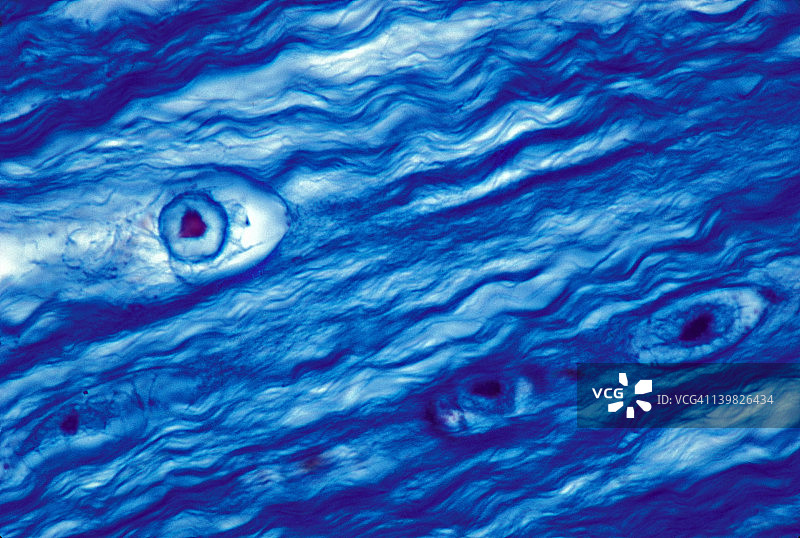 纤维软骨软骨细胞、腔隙、胶原纤维1000倍图片素材