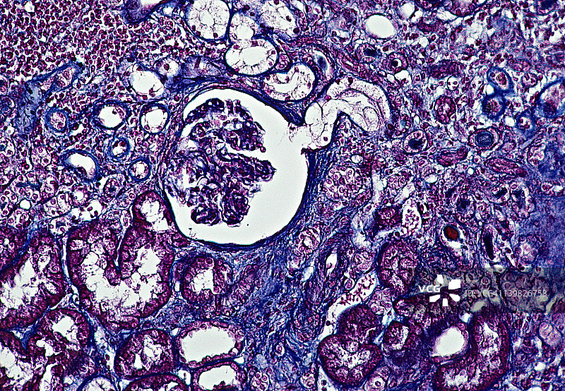 肾脏：肾单位、肾小球、肾小囊等结构（50倍放大）图片素材