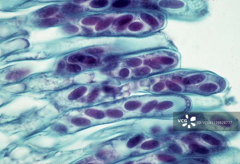 羊肚菌子囊菌的子囊和子囊孢子（250倍）图片素材
