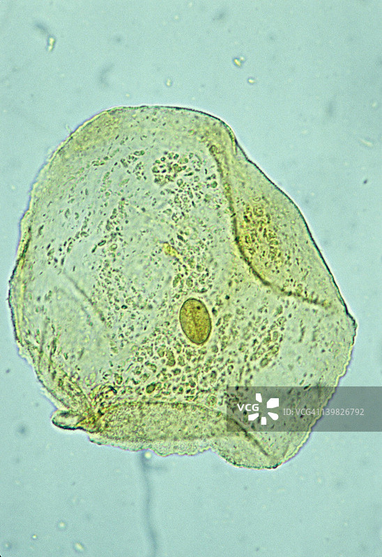 颊细胞：人口腔鳞状上皮细胞（250倍，碘染色），显示细胞核、细胞质和细胞膜图片素材