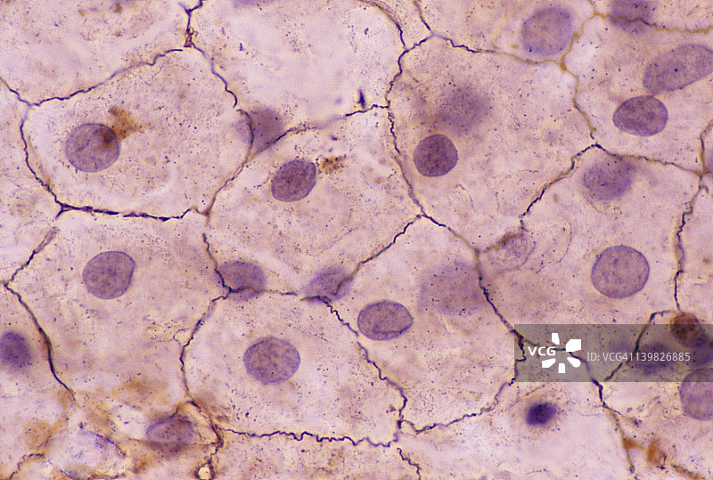 单层鳞状上皮细胞表面图图片素材