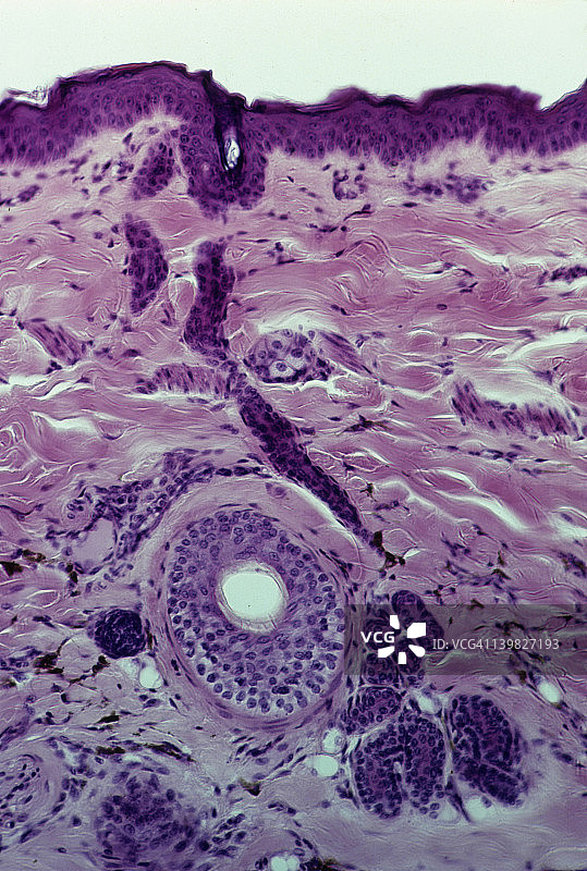 人类头皮上的汗腺和导管横截面图片素材