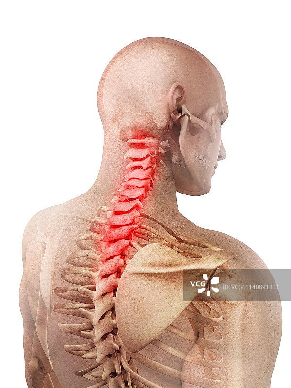 背部疼痛，概念艺术品图片素材