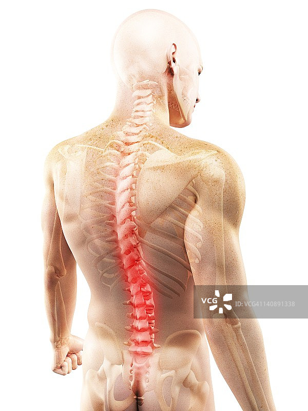 背部疼痛，概念艺术品图片素材