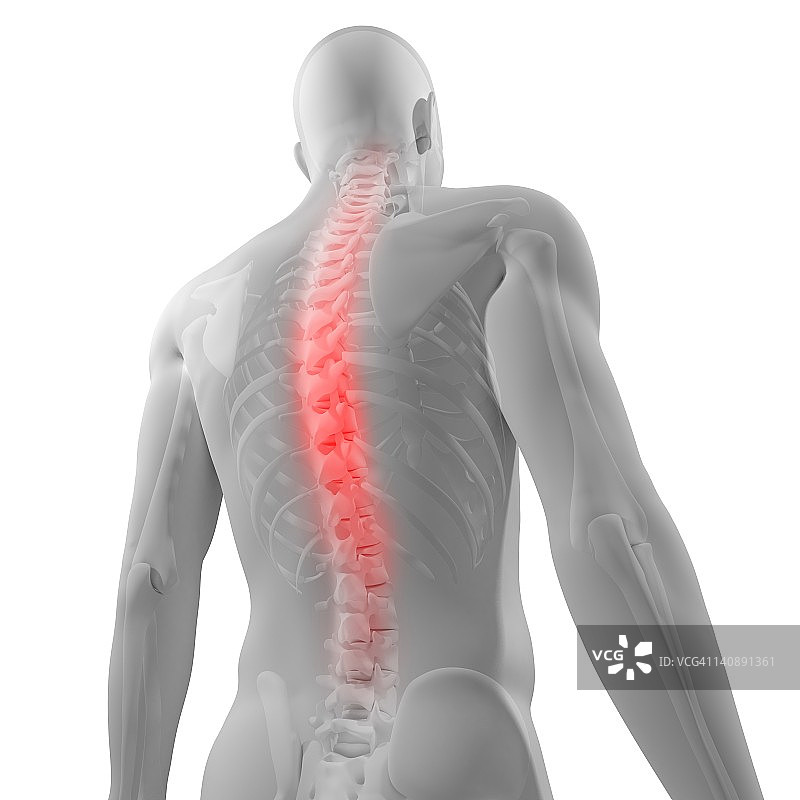 背部疼痛，概念艺术品图片素材