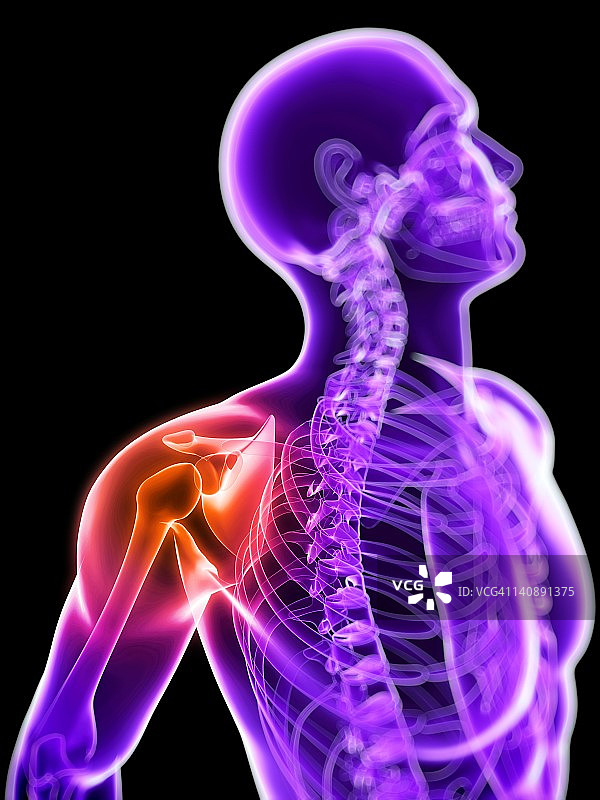 肩部疼痛概念艺术作品图片素材