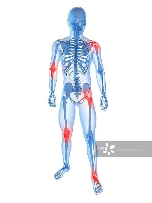 关节疼痛概念艺术作品图片素材