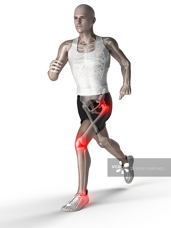 关节疼痛概念艺术作品图片素材