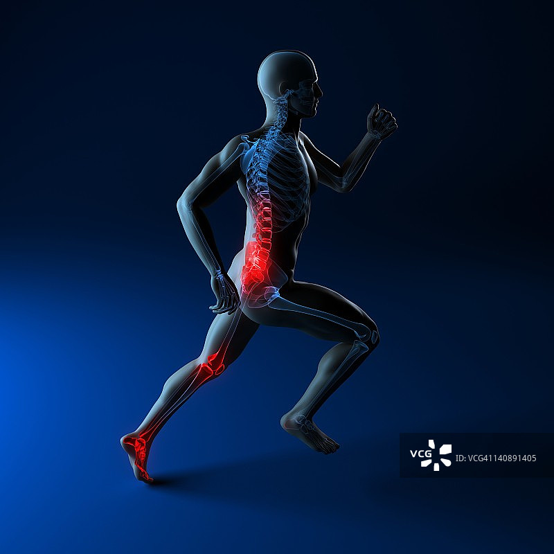 跑步损伤概念艺术图片素材