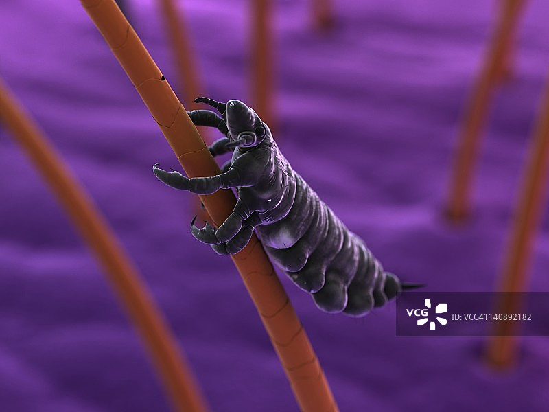 头虱艺术图图片素材