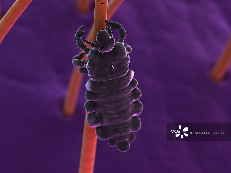 头虱艺术图图片素材