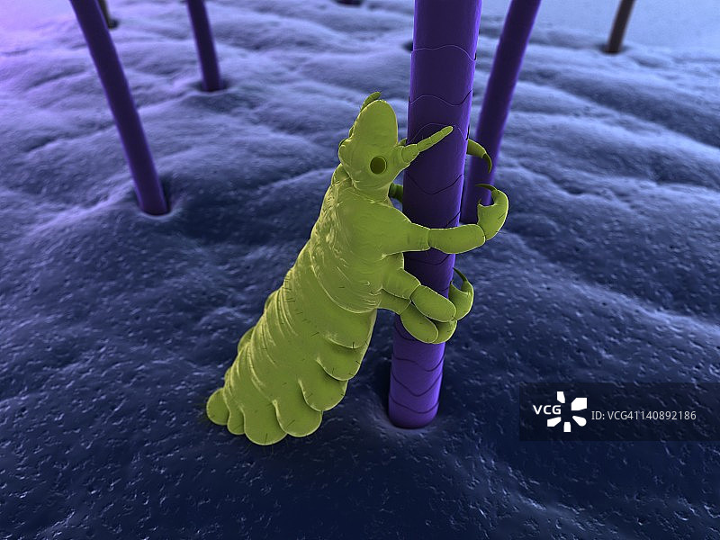 头虱艺术图图片素材