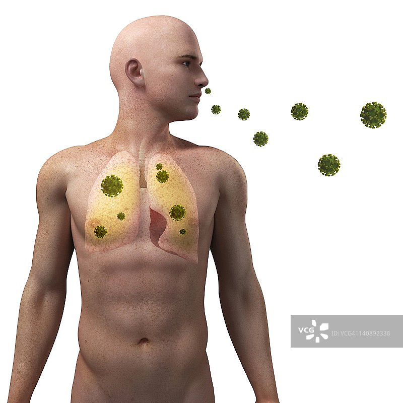 病毒性肺部感染概念图图片素材