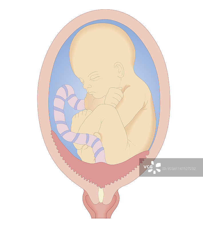 前置胎盘的生物医学横截面图图片素材