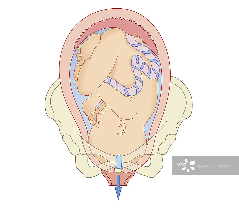 胎儿在分娩第一阶段位于骨盆内的生物医学横截面图图片素材