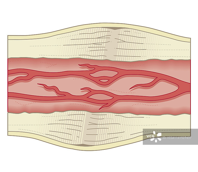 骨骼修复生物医学横截面图图片素材