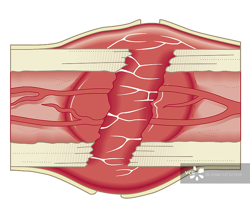 骨骼修复生物医学横截面图图片素材