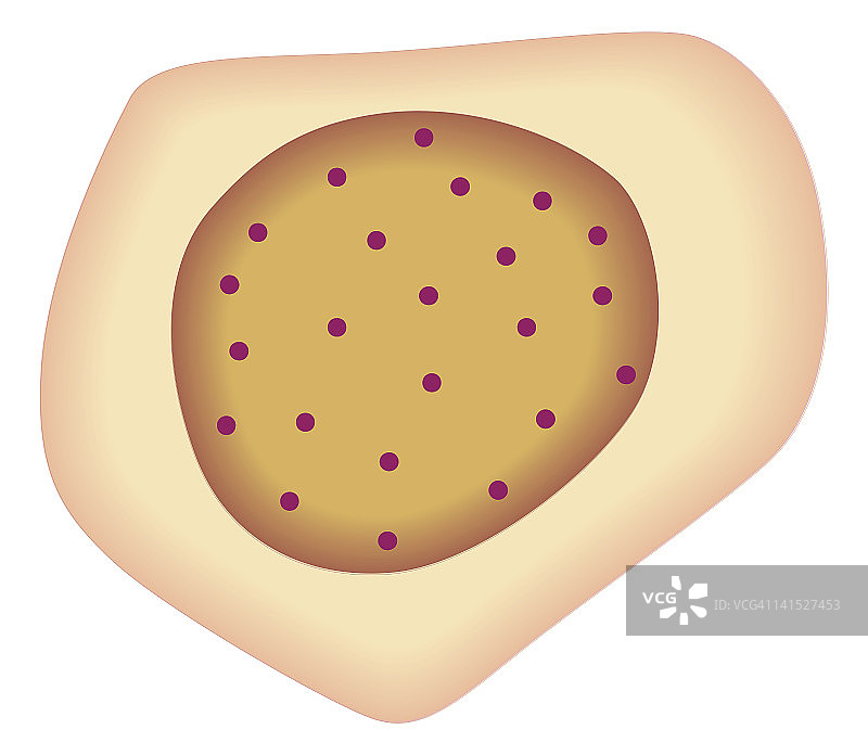 形成肿瘤的癌细胞生物医学横截面图图片素材