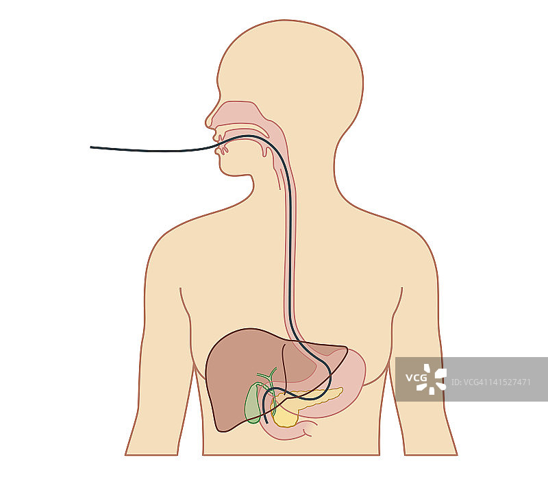 内窥镜路径的生物医学横截面图图片素材
