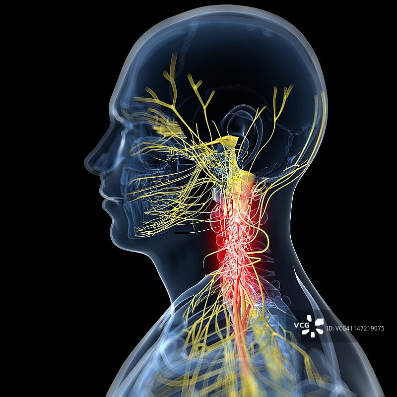 颈部疼痛概念艺术作品图片素材