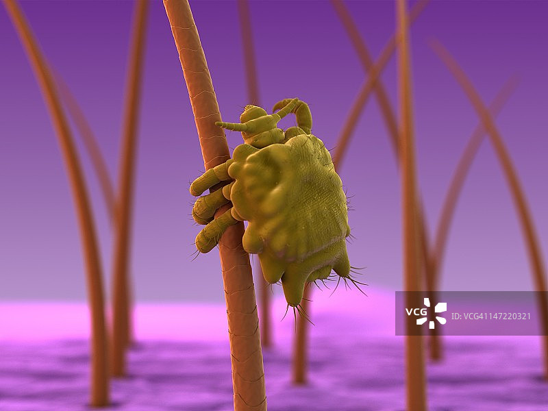 阴虱，艺术作品图片素材