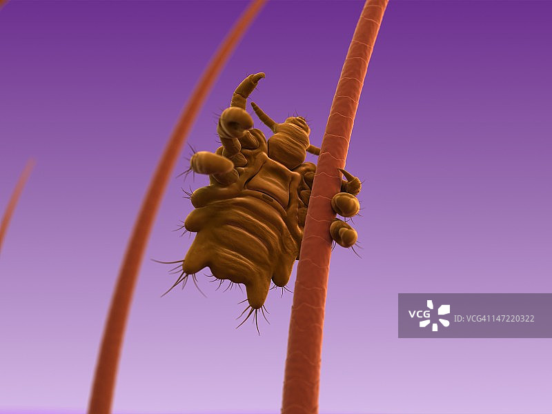 阴虱，艺术作品图片素材