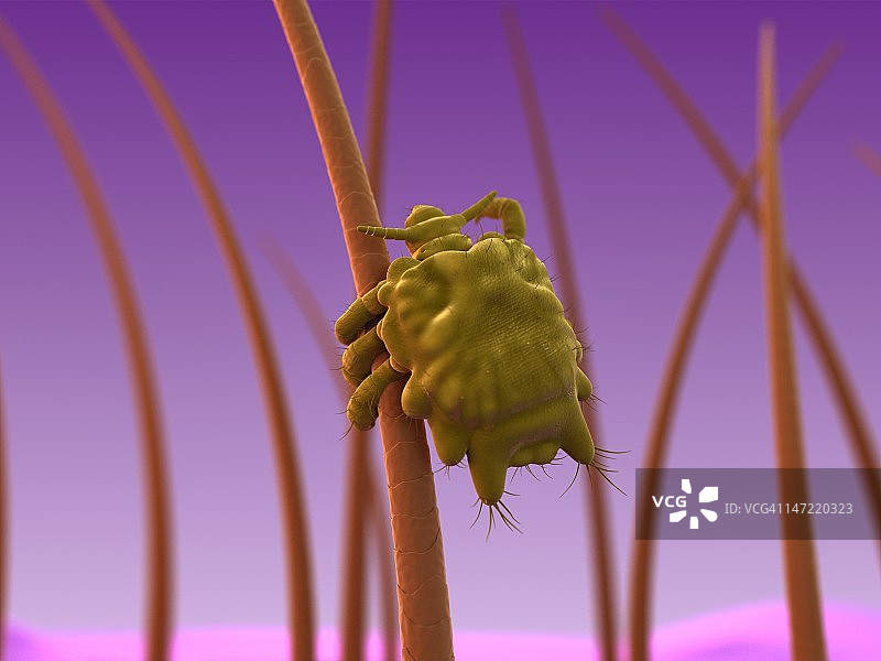 阴虱，艺术作品图片素材