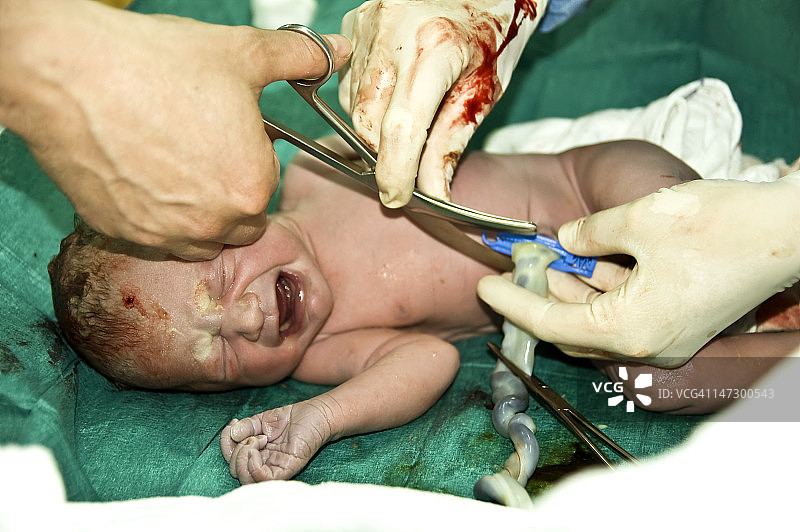 婴儿出生图片素材