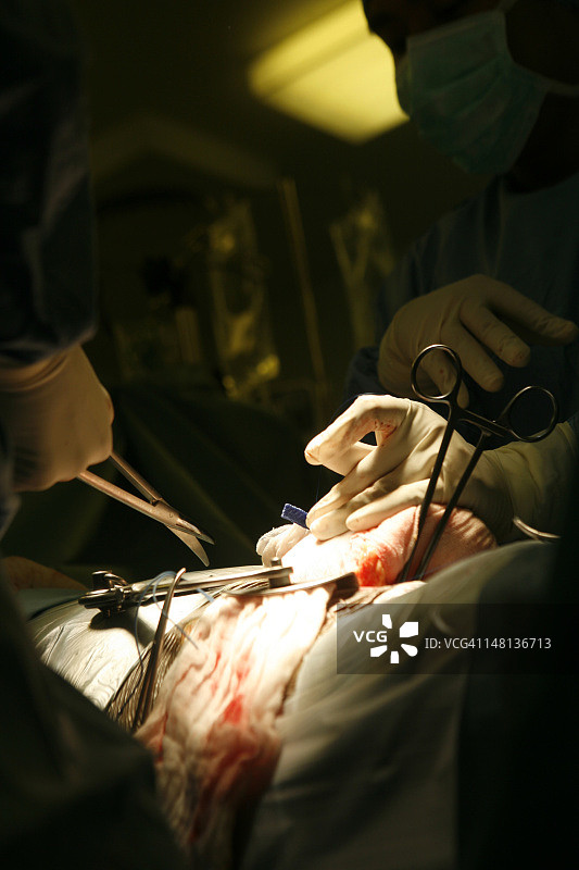 医院里的肾移植手术图片素材