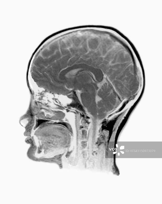 人脑核磁共振扫描图片素材