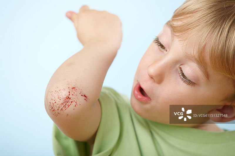 擦伤手肘的男孩图片素材