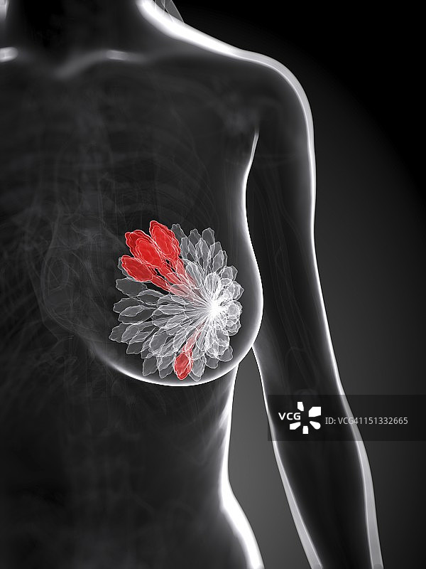 乳腺癌艺术作品图片素材