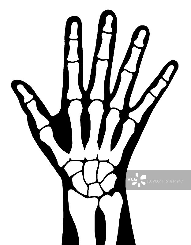 X光手部图片素材