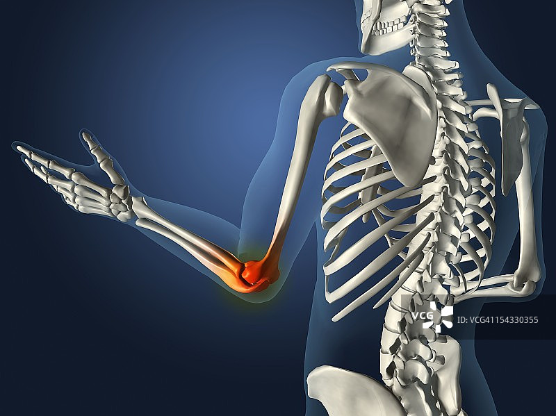 肘关节X光片：透明手臂、手部和脊椎骨，红色炎症图片素材