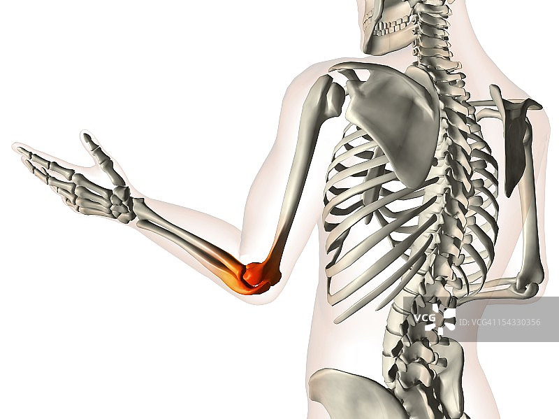 肘关节X光片：透明手臂、手部和脊椎骨，红色炎症图片素材