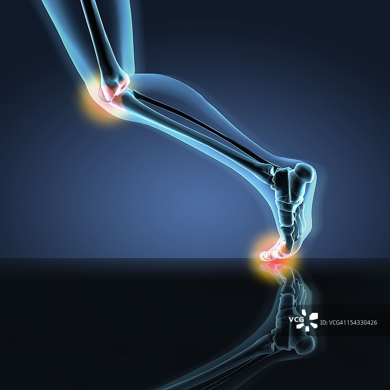 跑步姿势中显示膝盖、脚踝和脚部疼痛的人腿X光片图片素材