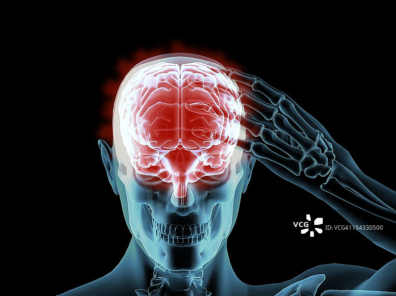 X光下的男子痛苦地抓着头骨图片素材