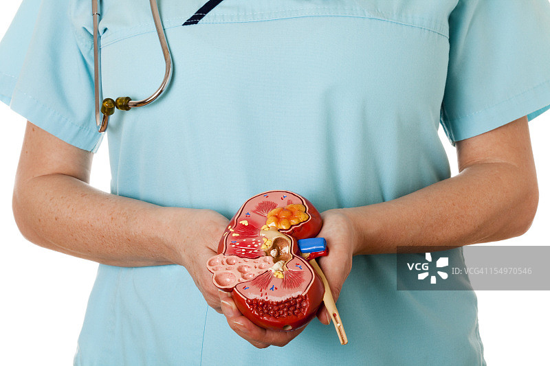 患病的肾脏图片素材