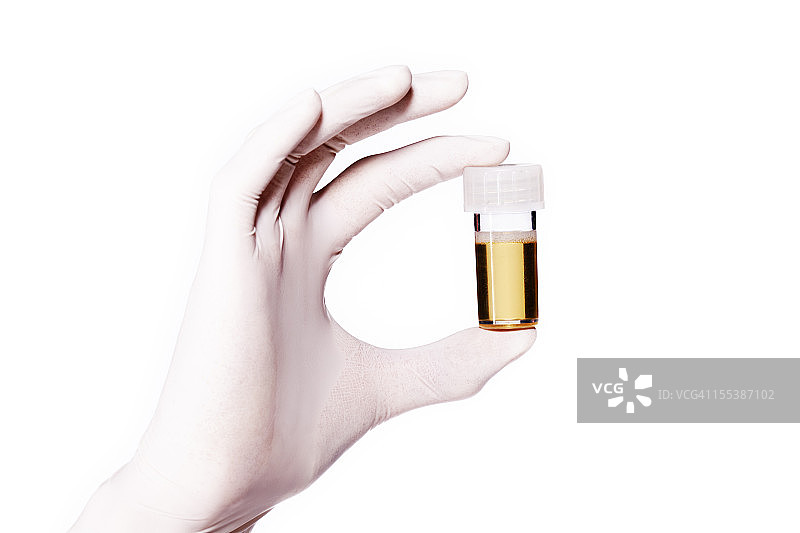 药物检测尿液样本图片素材