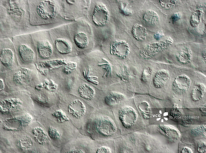 显微镜下观察的植物细胞核中的后期图片素材