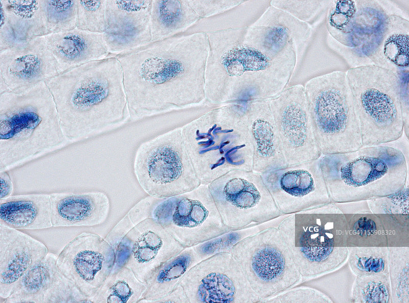 染色用于细胞核的植物细胞，其中一个细胞处于中期图片素材