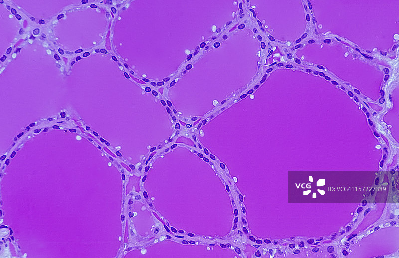 显示充满胶体的滤泡的甲状腺图片素材