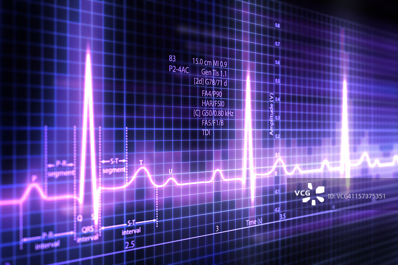 心电图图片素材