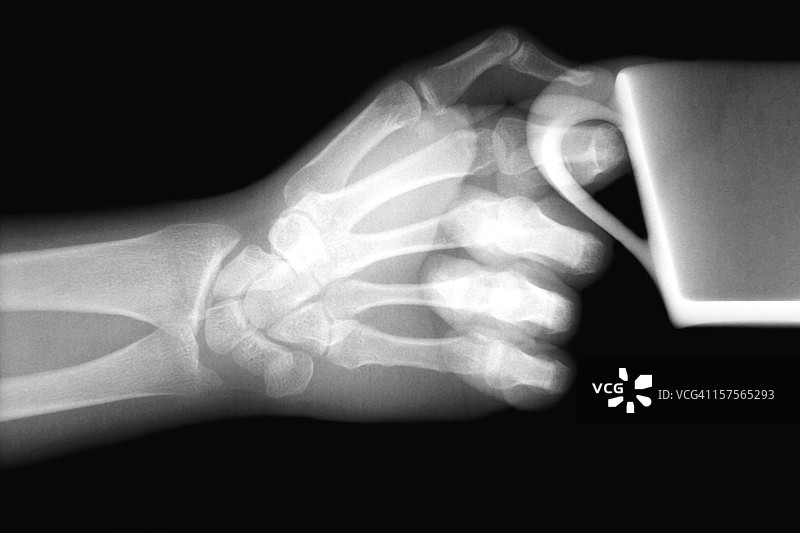 手和特大杯咖啡的X光片图片素材